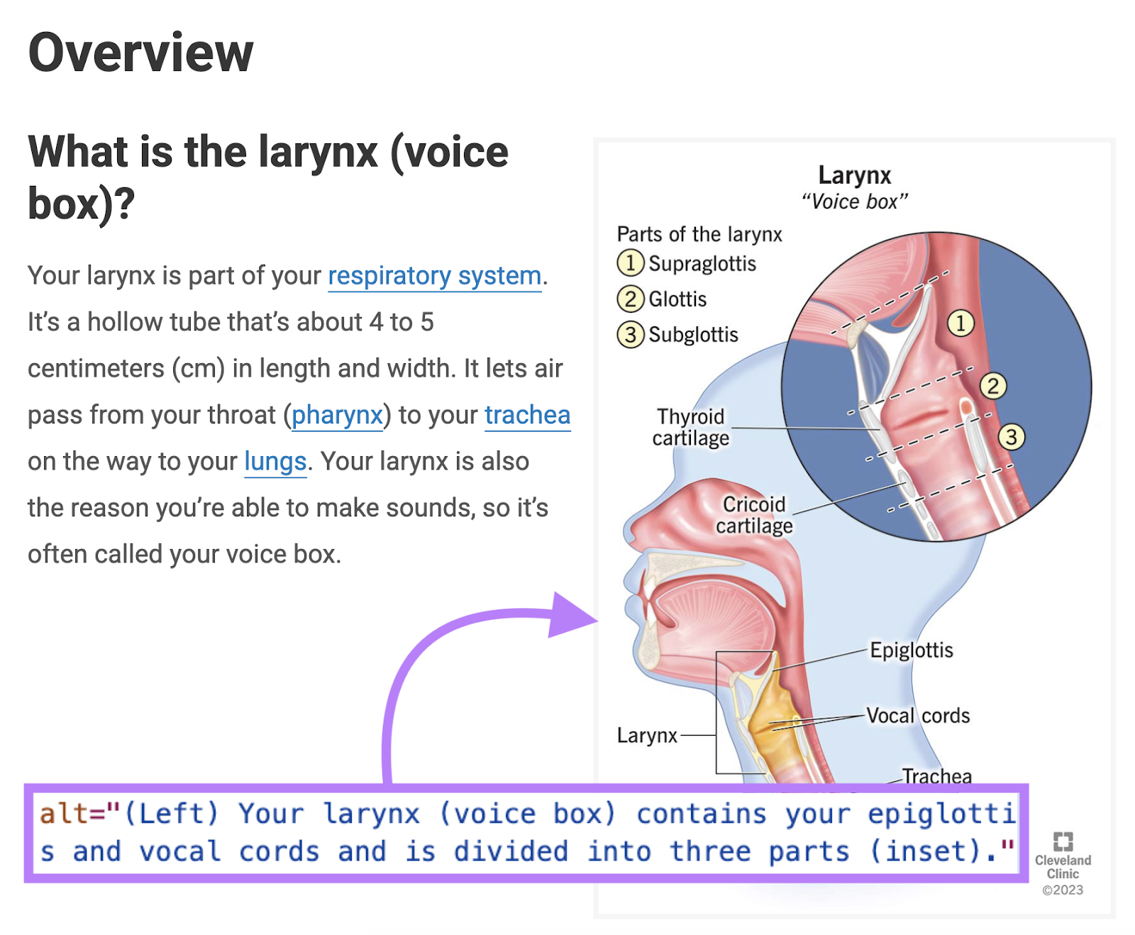 A picture shows a chart over a throat and all the text says, "Your larynx (voting booth) contains your epiglottis and vocal tape ..."