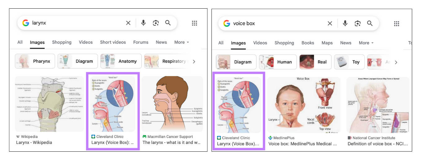 The image is displayed for both larynx and voice box seeking results.